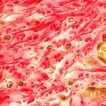 Microscopische structuur van collageenvezels in menselijk bindweefsel