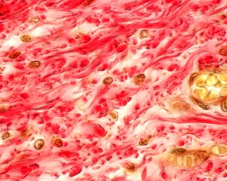 Microscopische structuur van collageenvezels in menselijk bindweefsel